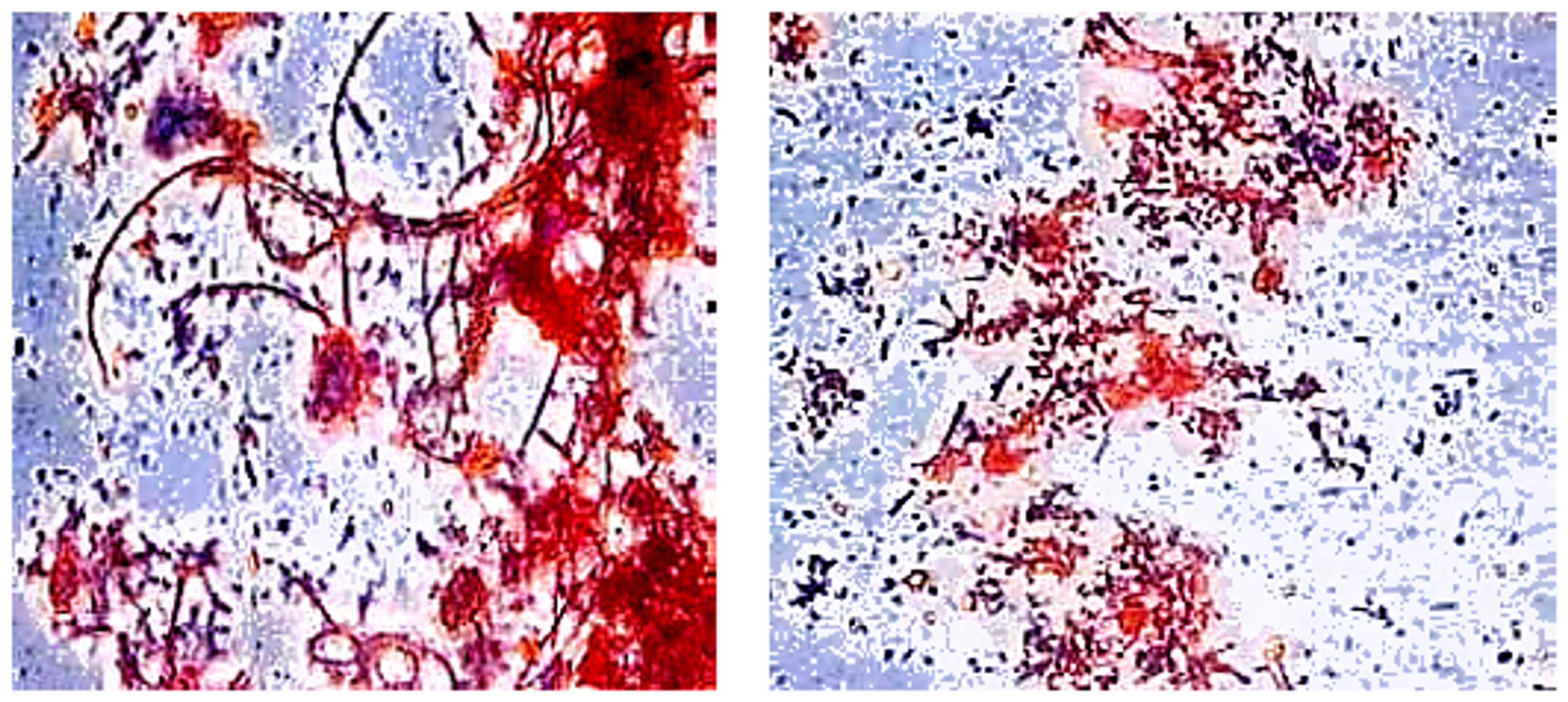 Figure 4.5. Activated sludge structure before and after cavitation