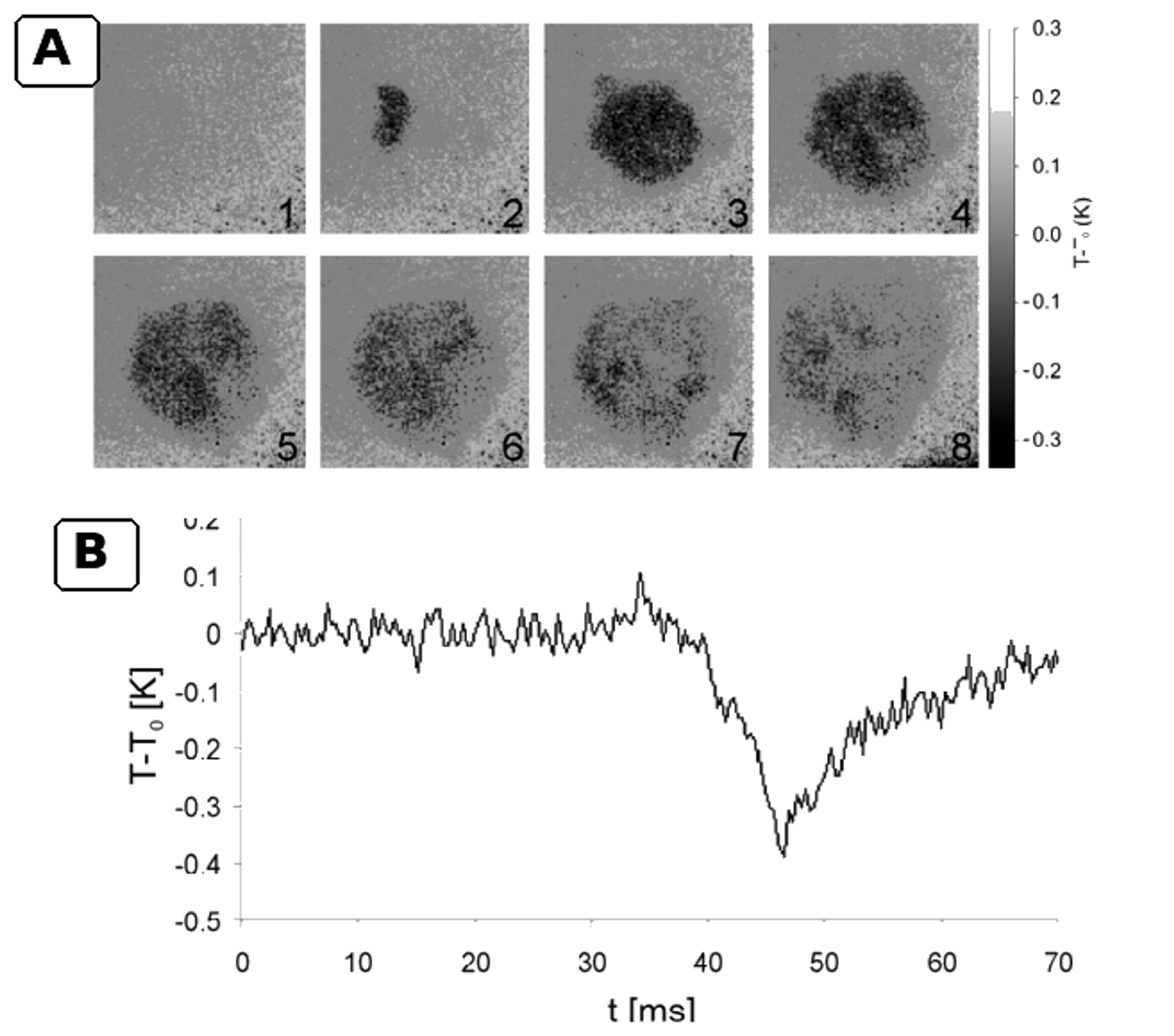 Figure 14.14. Infrared thermography of cavitation associated local cooling during bubble growth. (74)